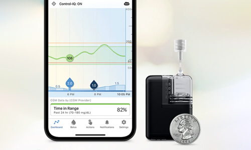 Tandem Mobi insulin pump and features